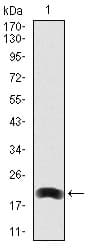 LRP5 Antibody (aa1422-1615, clone 2B11)