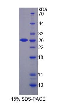 Human SNX17 Protein (Recombinant His-S)