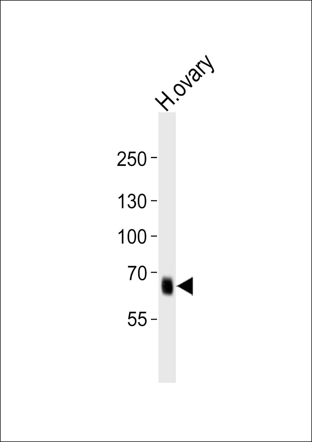 IHC-plus™ PRDM13 Antibody (aa2-36)