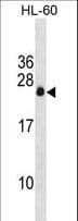 Polyclonal Rabbit anti-Human APRG1 Antibody (aa59-88, WB)