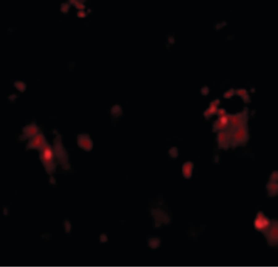 TRAIL-R3 / DCR1 Antibody