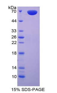 Human CPA3 Protein (Recombinant His-GST)