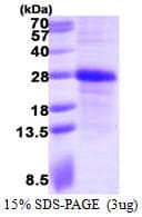 Human EFNA1 / Ephrin A1 Protein (Recombinant His)