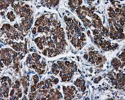 ATP5B / ATP Synthase Beta Antibody (clone OTI1F7, Carrier-free)
