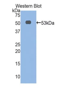 Alpha-Fetoprotein Antibody (aa409-611)