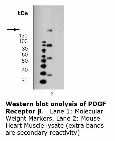 IHC-plus™ Monoclonal Mouse anti-Human PDGFRB / PDGFR Beta Antibody (clone 42G12, IHC, WB)