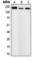 SCN1A / Nav1.1 Antibody (Internal)