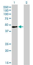 PathPlus™ Monoclonal Mouse anti-Human TFAP2A / AP-2 Antibody (clone 2G5, IHC, WB)