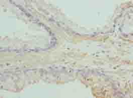 ACTG2 Antibody