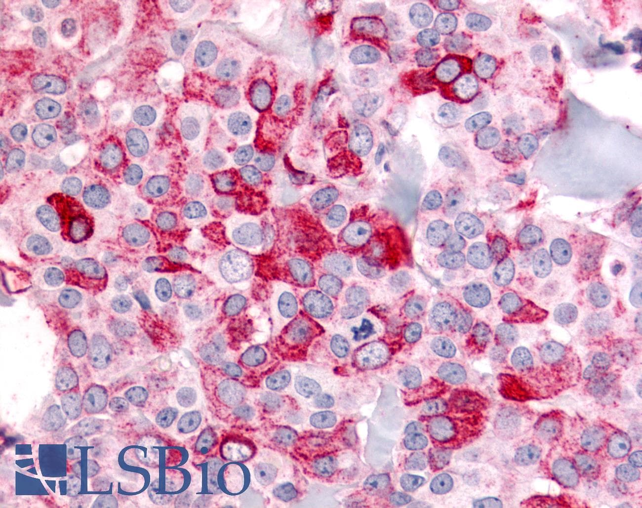 PathPlus™ ADGRB2 / BAI2 Antibody (N-Terminus)