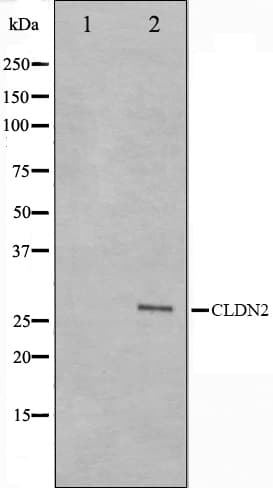 Polyclonal Rabbit anti-Human CLDN2 / Claudin 2 Antibody (IHC, IF, WB)