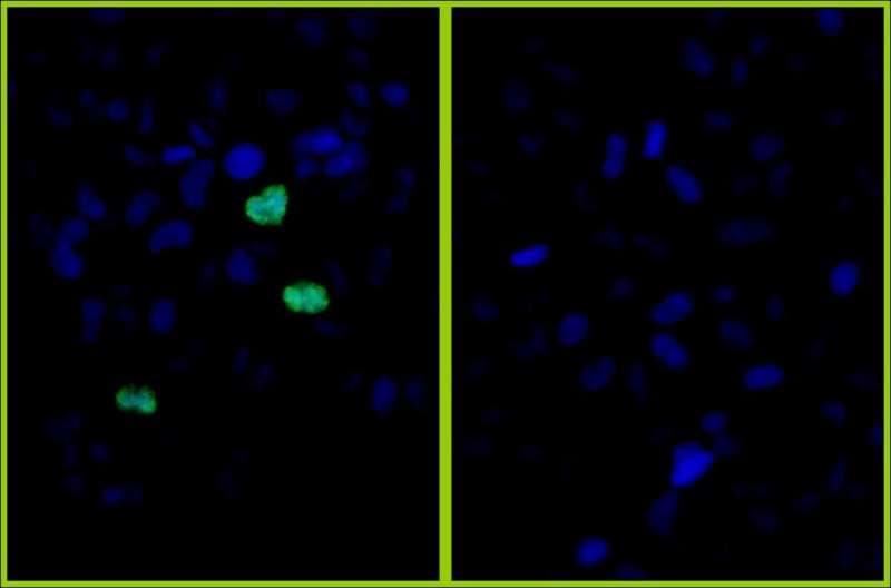HIST1H3A Antibody (phospho-Ser10)