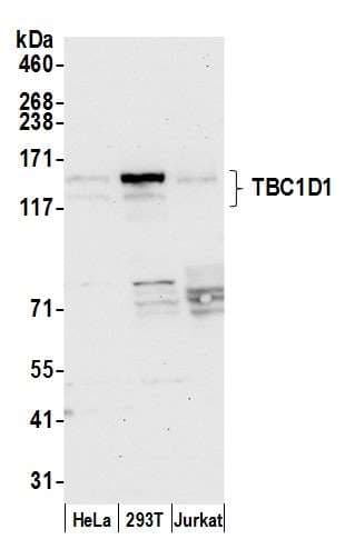 Polyclonal Rabbit anti-Human TBC1 / TBC1D1 Antibody (aa1118-1168, WB)