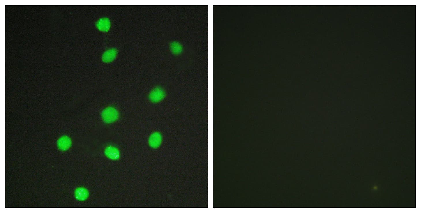 Polyclonal Rabbit anti-Human GLI3 Antibody (aa11-60, IHC, IF)
