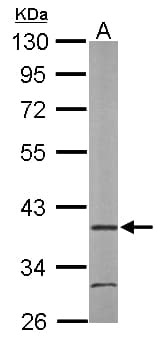 IHC-plus™ ARA9 / AIP Antibody (Internal)