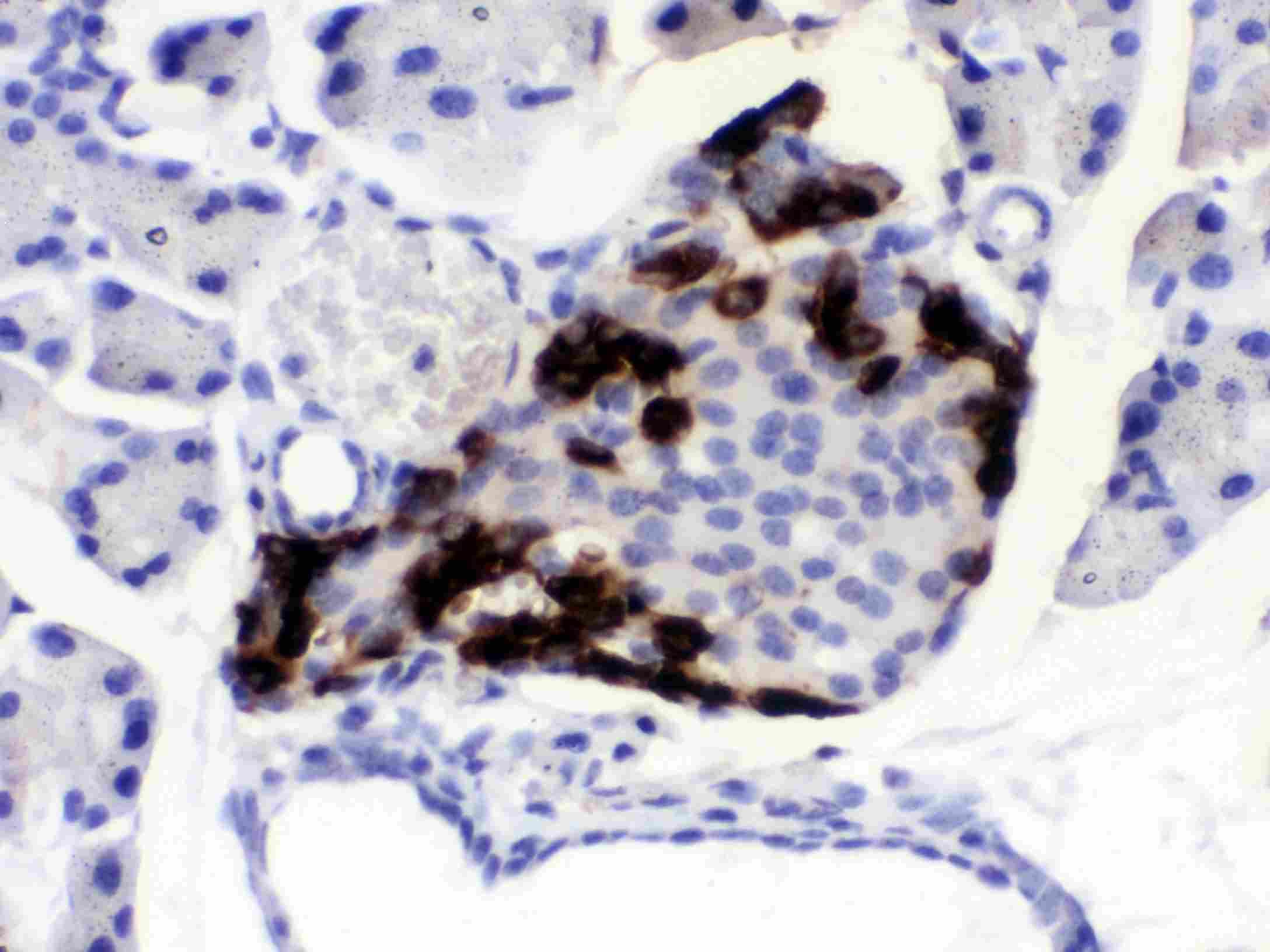VIP Antibody