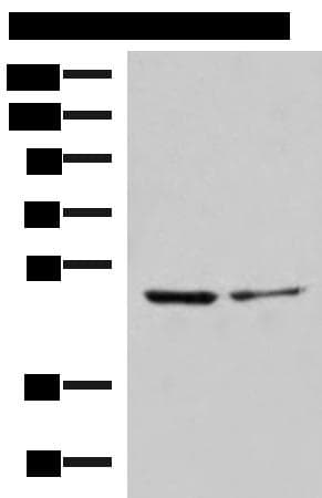 Polyclonal Rabbit anti-Human ECSIT Antibody (IHC, WB)