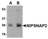 GBAS Antibody