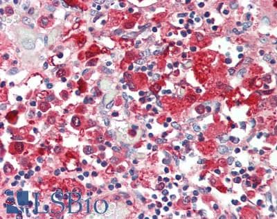 IHC-plus™ ALKBH1 / ALKB Antibody (aa110-389)