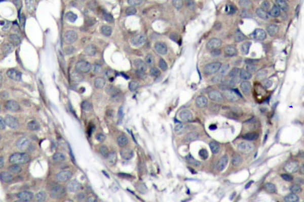 Polyclonal Rabbit anti-Human HSPB1 / HSP27 Antibody (Ala72, IHC, WB)
