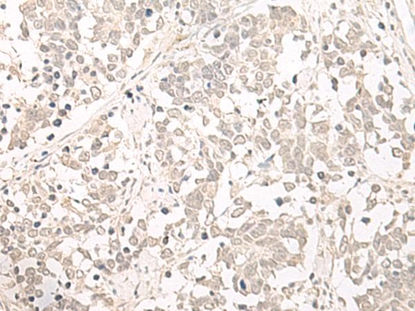 Polyclonal Rabbit anti-Human OLA1 Antibody (IHC)
