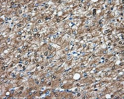 Monoclonal Mouse anti-Human DNTTIP1 / TDIF1 Antibody (clone OTI1F4, IHC, IF, WB)