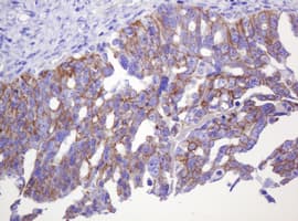 CTNND1 / p120 Catenin Antibody (clone OTI2E8)