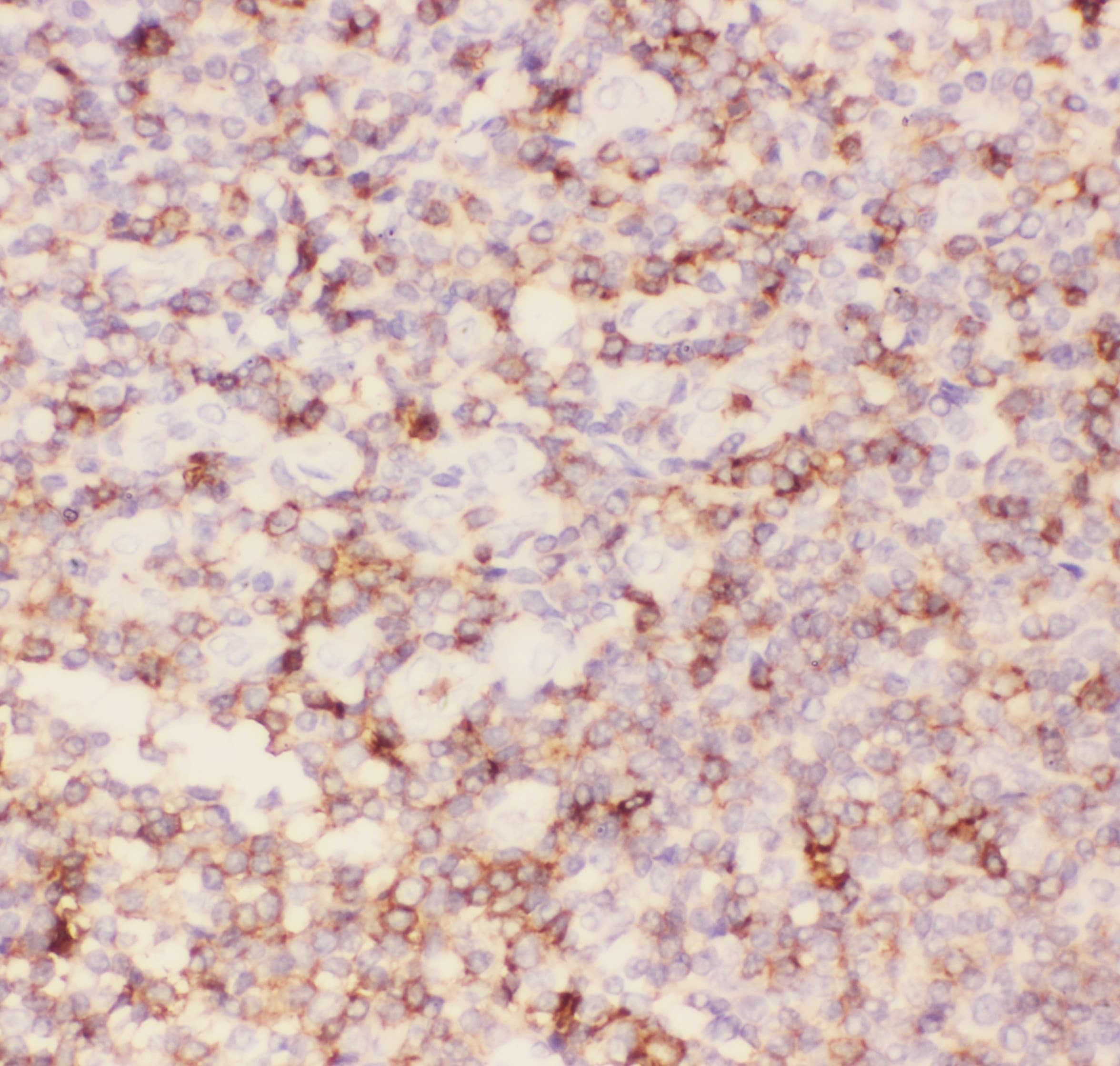 Polyclonal Rabbit anti-Human SPN / CD43 Antibody (aa272-400, IHC, WB)