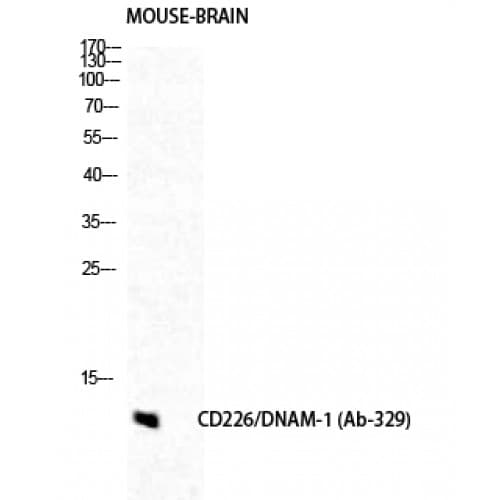 DNAM-1 / CD226 Antibody (270-350 aa)