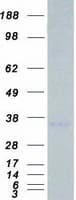 Human STC2 / Stanniocalcin 2 Protein (Recombinant Myc-DDK (Flag))