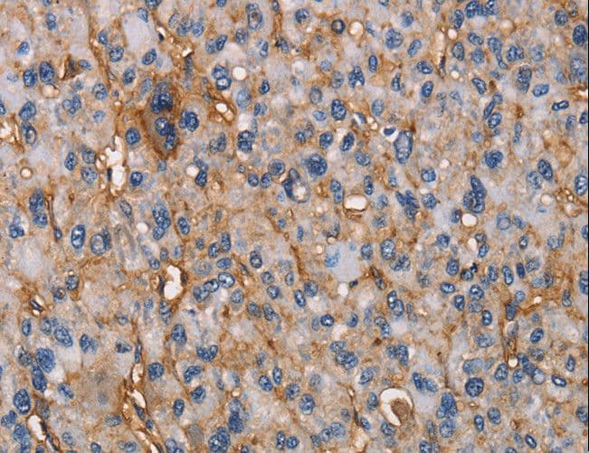 NT5E / eNT / CD73 Antibody
