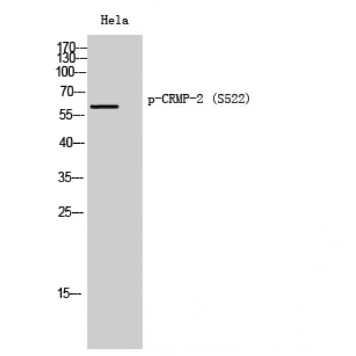DPYSL2 / CRMP2 Antibody (460-540 aa)