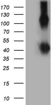 Monoclonal Mouse anti-Human CD30 Antibody (clone UMAB256, aa408-595, IHC, WB)