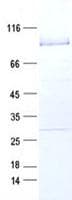 Human RIPK3 / RIP3 Protein (Recombinant GST, N-terminus)