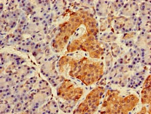 RAB27A / RAB27 Antibody