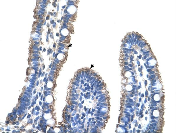 TMEM8B / NGX6 Antibody (aa201-250)