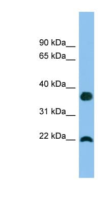 Polyclonal Rabbit anti-Human PS20 / WFDC1 Antibody (C-Terminus, WB)