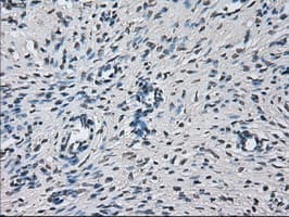 PRL / Prolactin Antibody (clone OTI11B11)