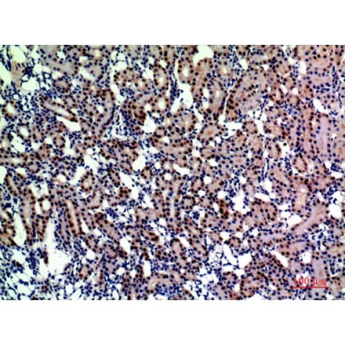 Polyclonal Rabbit anti-Human ENPEP / Aminopeptidase A Antibody (671-720 aa, Internal, IHC, WB)