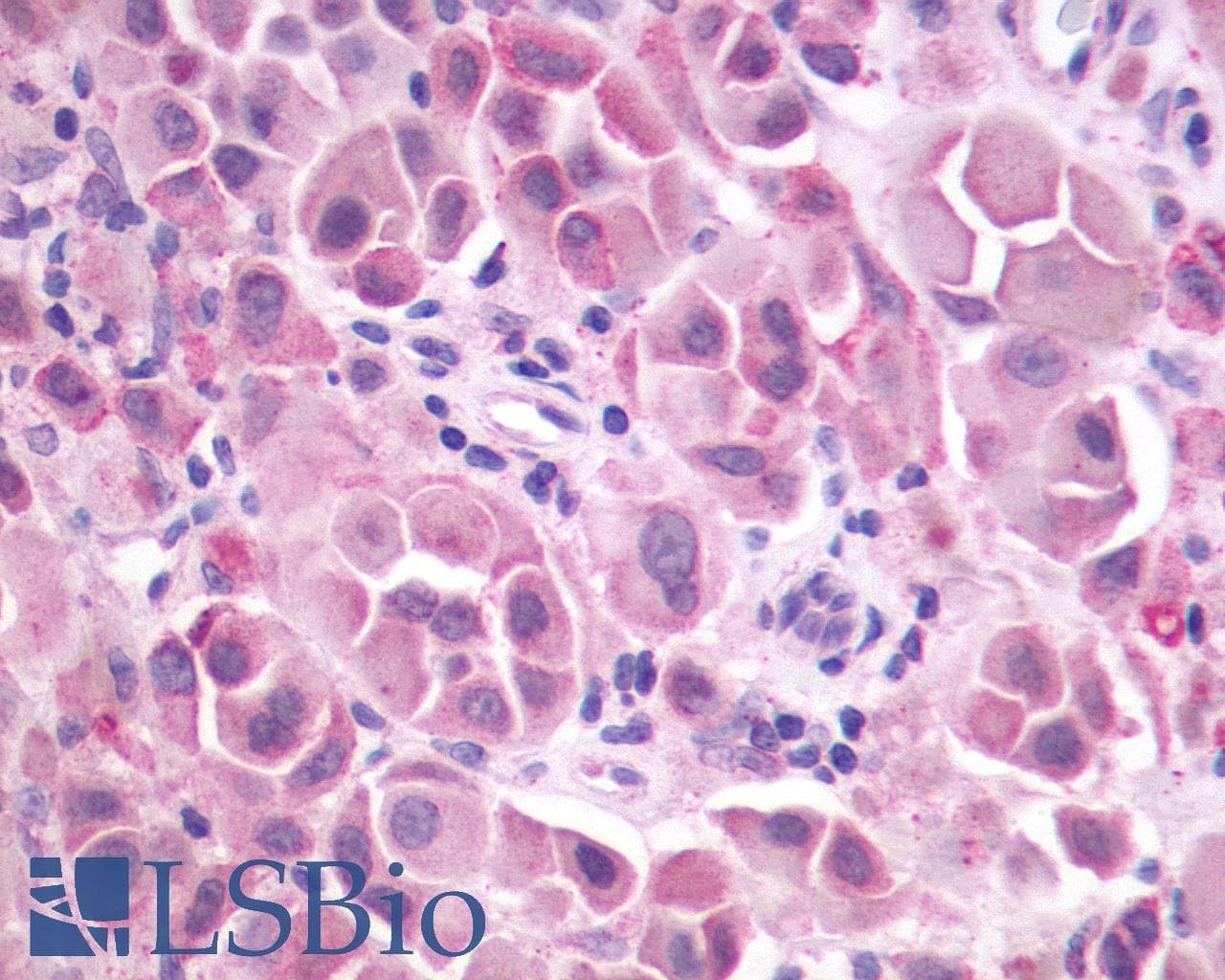PathPlus™ GRM3 / MGLUR3 Antibody (N-Terminus)