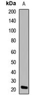 HSPB8 / H11 / HSP22 Antibody