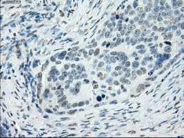 SSX2 Antibody (clone OTI4A11)