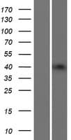 B3GNT4 Protein (Over-Expression Lysate Myc-DDK (Flag))