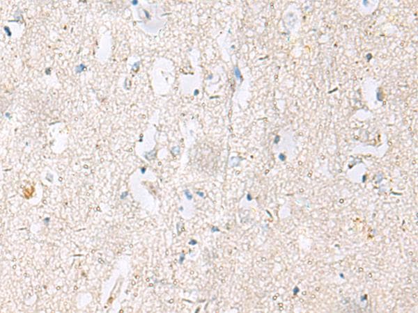 DACT3 Antibody