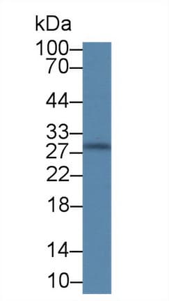 MBL2 / Mannose Binding Protein Antibody (aa19-244)