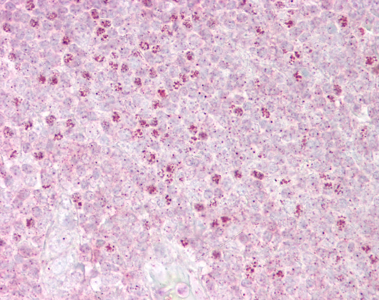 Polyclonal Rabbit anti-Human OAS1 Antibody (C-Terminus, IHC, WB)