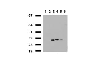 Monoclonal Mouse anti-Human HADH Antibody (clone UMAB151, aa57-314, IHC, WB)