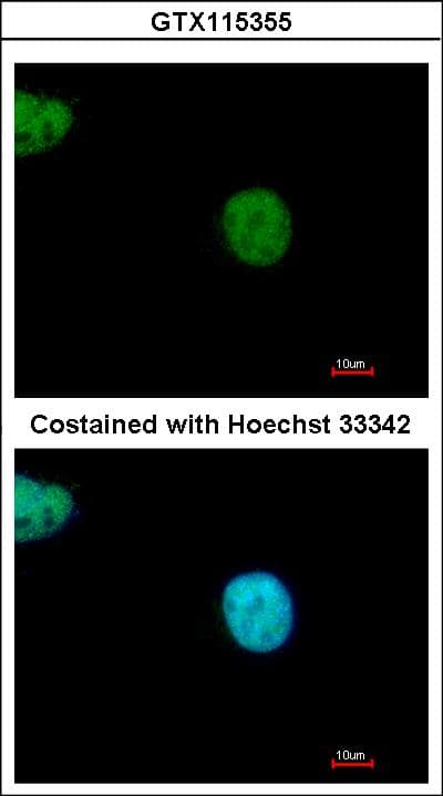 Polyclonal Rabbit anti-Human YAF2 Antibody (IF, WB)