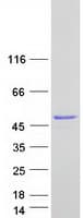 Human UBFD1 Protein (Recombinant Myc-DDK (Flag))