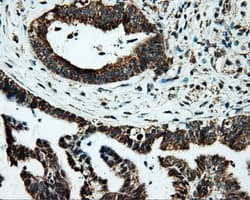 PTPRE / PTP Epsilon Antibody (clone OTI5F2)
